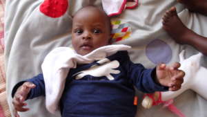 Recovering from severe malnutrition