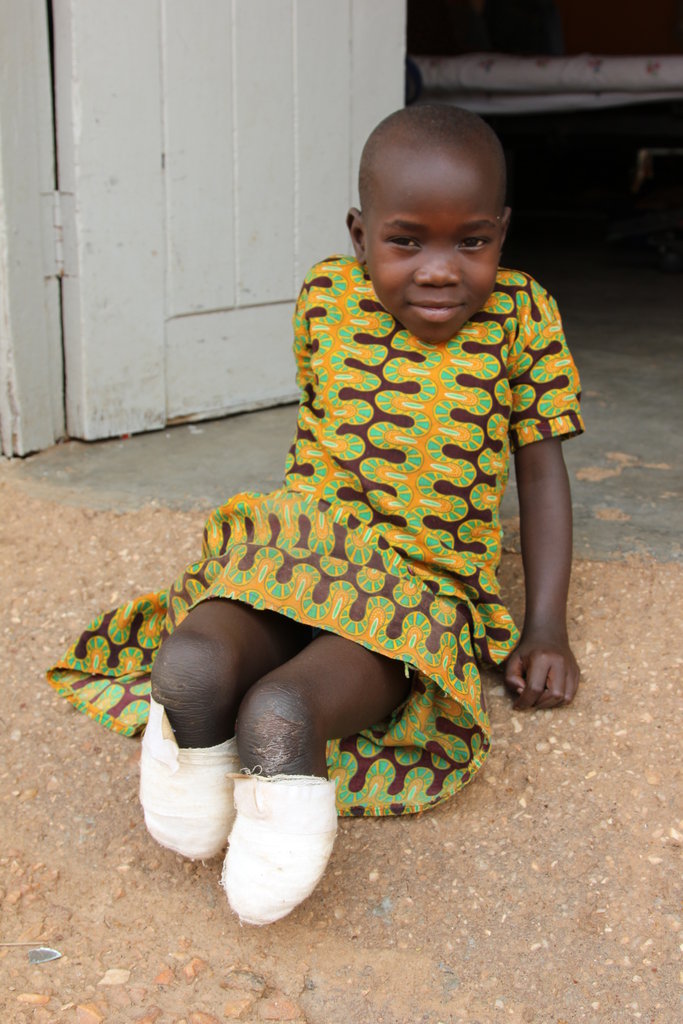 Enable 150 Ugandan children rise above disability