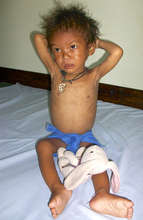 Jal when he was admitted to the NRH