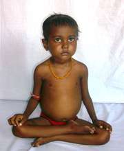 Rajeev Thakur after 18 days at NRH