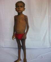 Rajeev Thakur at Admission to Rajbiraj NRH