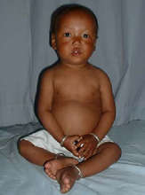 ...Akha after just a few weeks of treatment