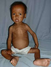 Krishna at admission to the NRH