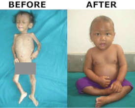 Before and After