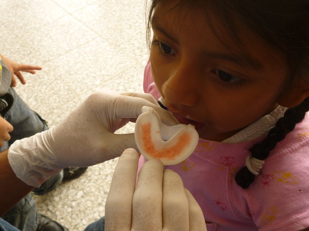 Preventive oral health program for rural children