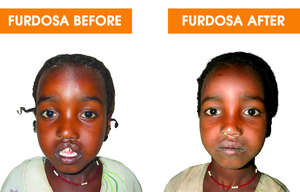 Furdosa