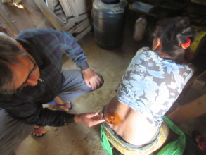 Ram Maya Baram, Insision and Drainage of abscess