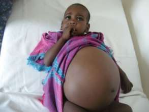 Musab before operation