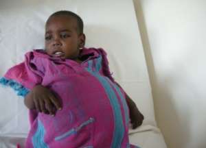 Musab before operation