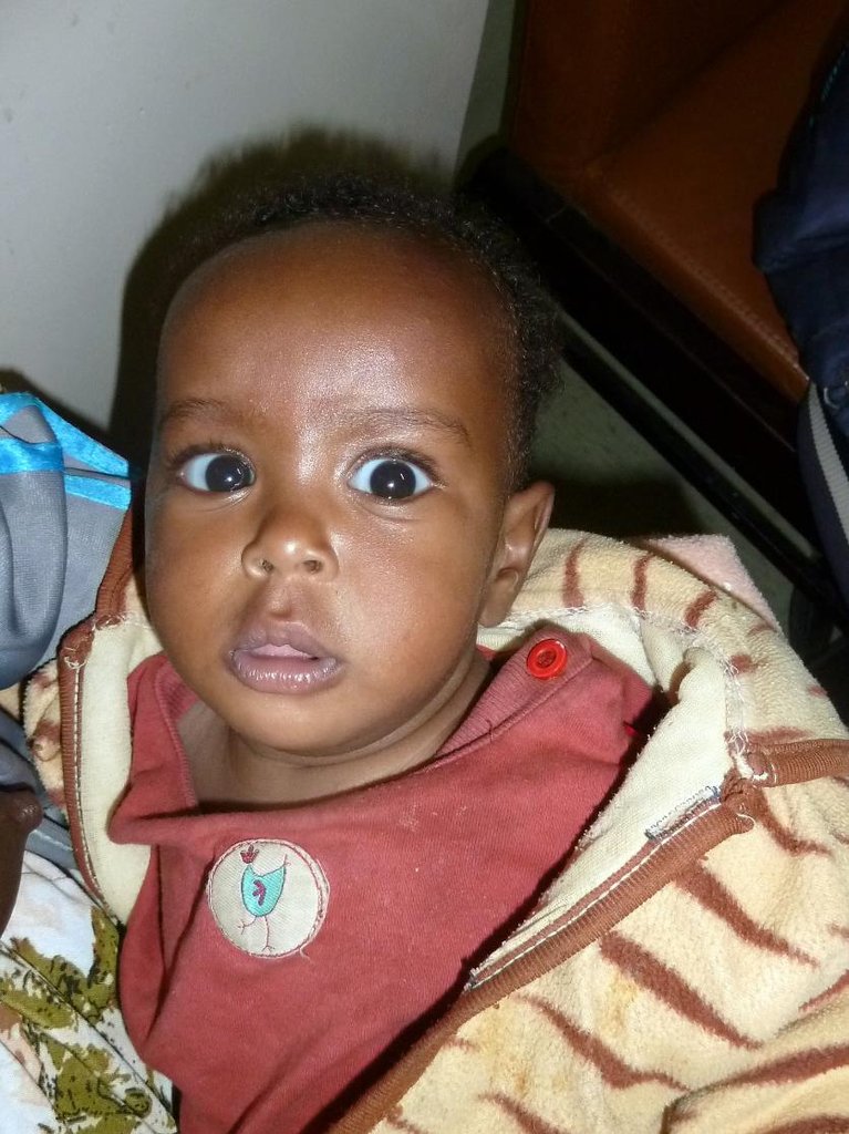 Provide Surgery for Children in Ethiopia