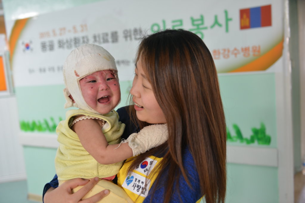 Support 32 burned Children in Mongolia