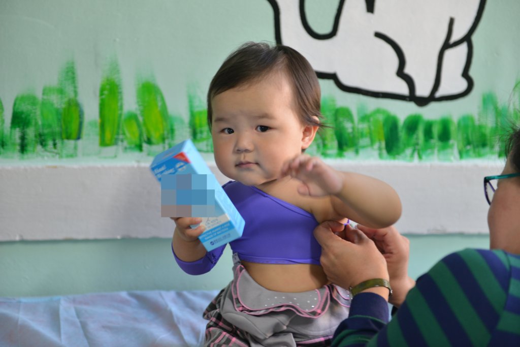 Support 32 burned Children in Mongolia