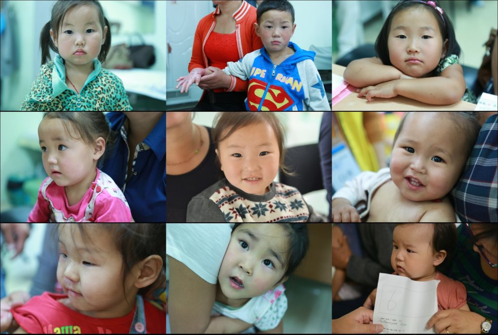 Support 32 burned Children in Mongolia