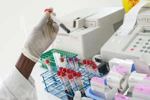 Blood samples in the lab