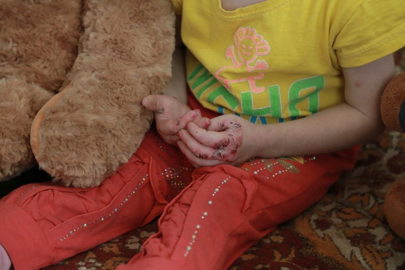Help Ksenia and 11 children with rare skin disease