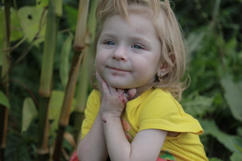 Help Ksenia and 11 children with rare skin disease - GlobalGiving
