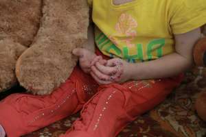 Systemic disease affects skin and internal organs