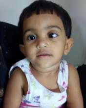 child operated for strabismus