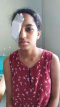 13 yr old operated for traumatic cataract