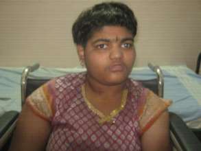15 yr old operated for cataract