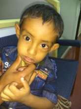 2.5 yr old treated for NLD block