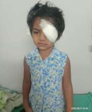 4 yr old child operated for chemical injury