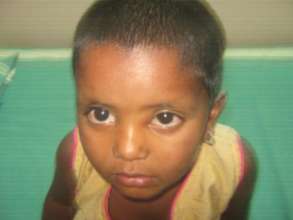 4 yr old female child operated for dermoid