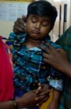 child treated for complicated cataract