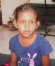 5 yr old child of cracker injury case