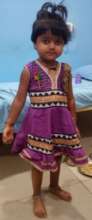 5 yrs old child operated for paediatric uveitis