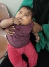 BABY OPERATED FOR CATARACT