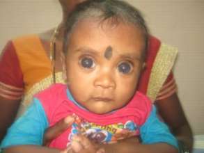 7 mths old baby examined for congenital glaucoma