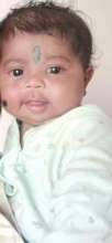 7 months baby operated for congenital glaucoma