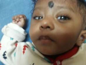 7 months old baby operated for cataract