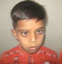 child operated for childhood glaucoma
