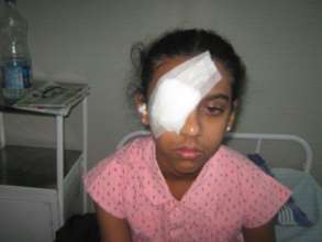 11 yr old girl operated for Glaucoma