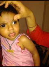 10month oldbaby operated for dislocated lens @VIIO