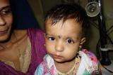 1yr old baby operated for deficient eye lid @IGICH