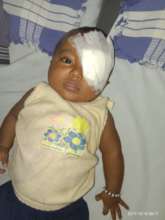 5 mn old baby 2nd eye operated