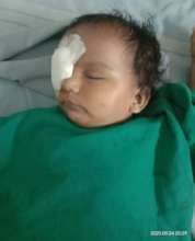 1 yr old baby post surgery