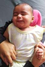 5 month old baby operated for congenital cataract