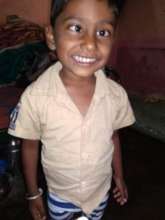 4 yr old boy before squint surgery