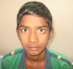 14 yrd old boy treated for limbal dermoid