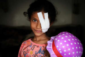 Razan, 8 years old after an airstrike in Yemen