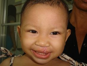 Charlyn Catalan-After