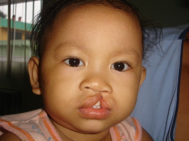 Charlyn Catalan- Before