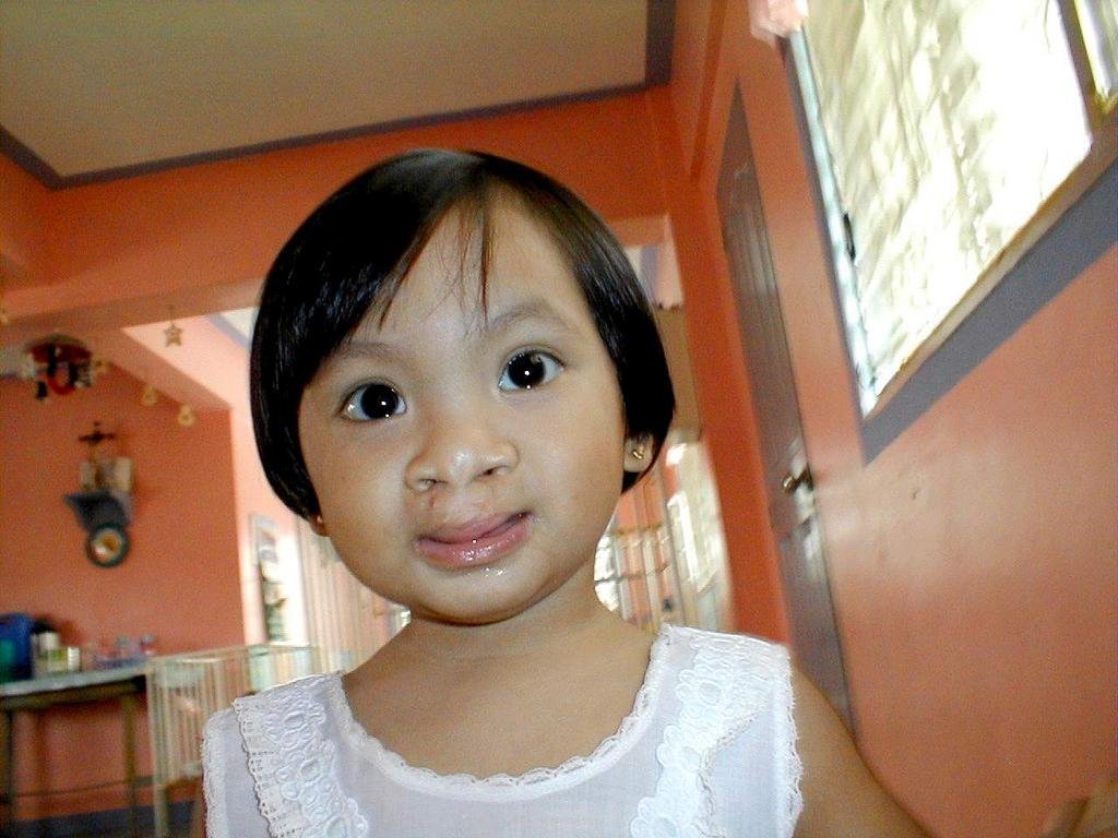 Free Cleft Surgery for 400 Filipino Children