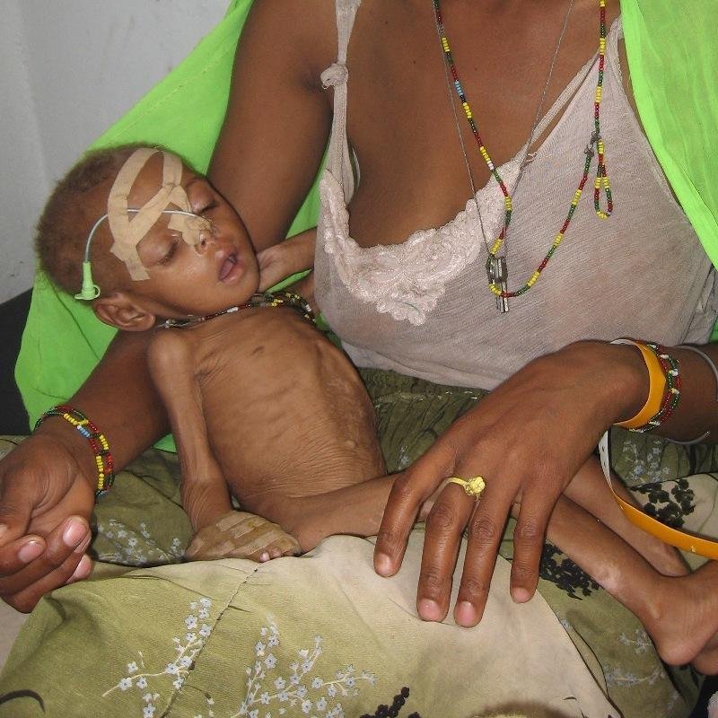 Emergency Food Aid for 7500 Starving Ethiopians