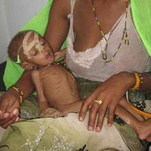 Starving Child