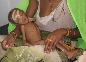 Emergency Food Aid for 7500 Starving Ethiopians